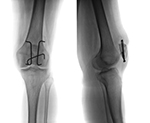 orthopaedics x ray